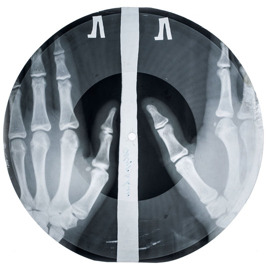 X-RAY AUDIO: The “Bone Music” of the Soviet Union